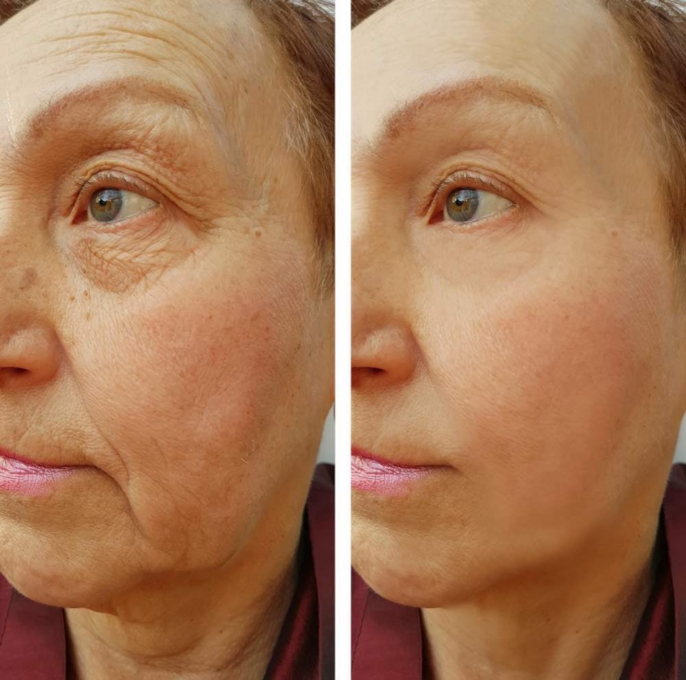 At-Home Cosmetic and Aesthetic Procedures in Loxahatchee, FL by Beyond Concierge Healthcare