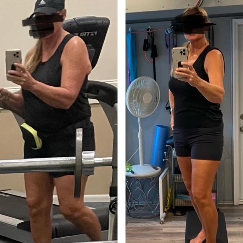 Weight Loss Before and After Royal Palm Beach, FL