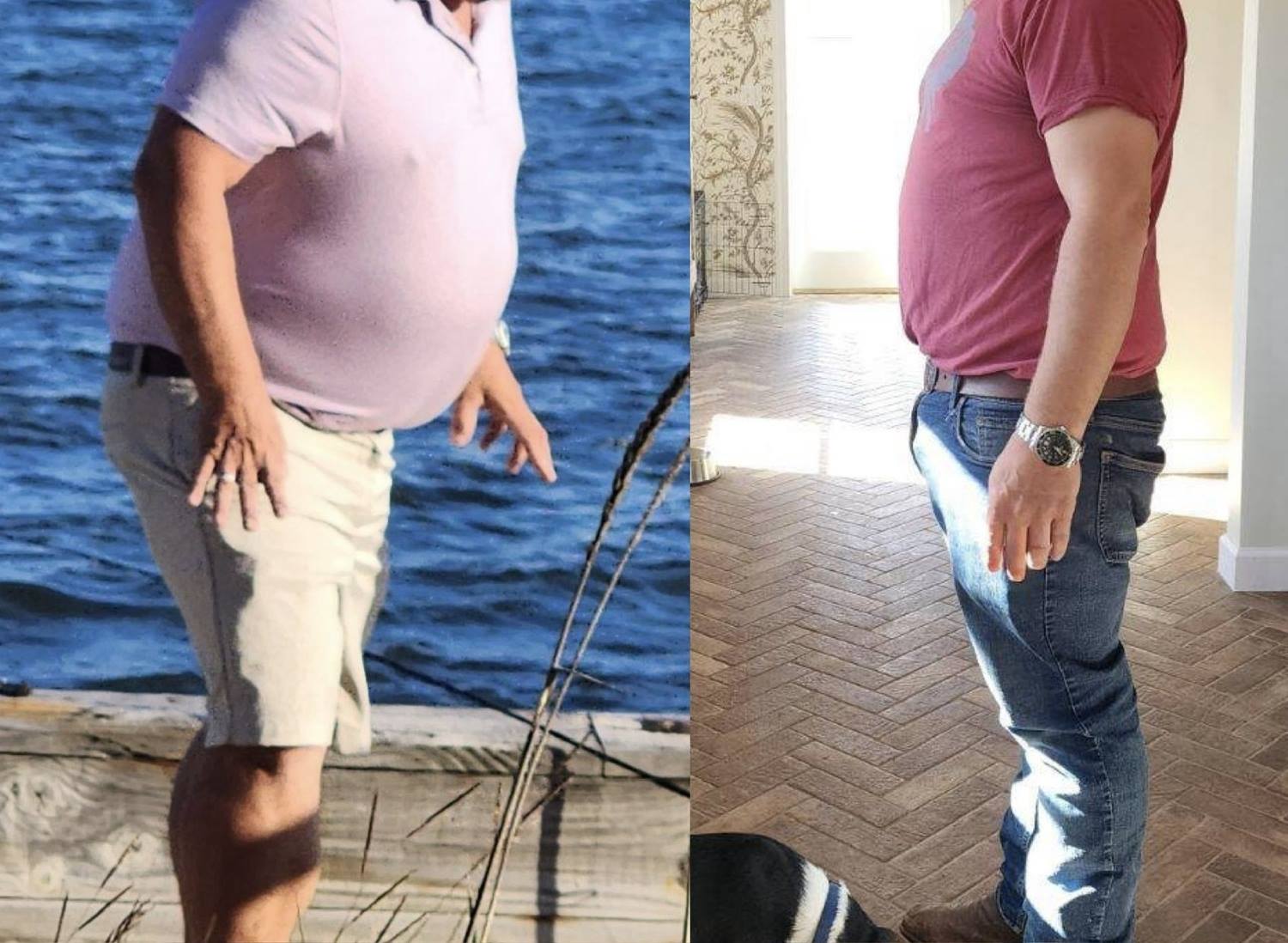Weight Loss Program in Wellington, FL by Beyond Concierge Healthcare
