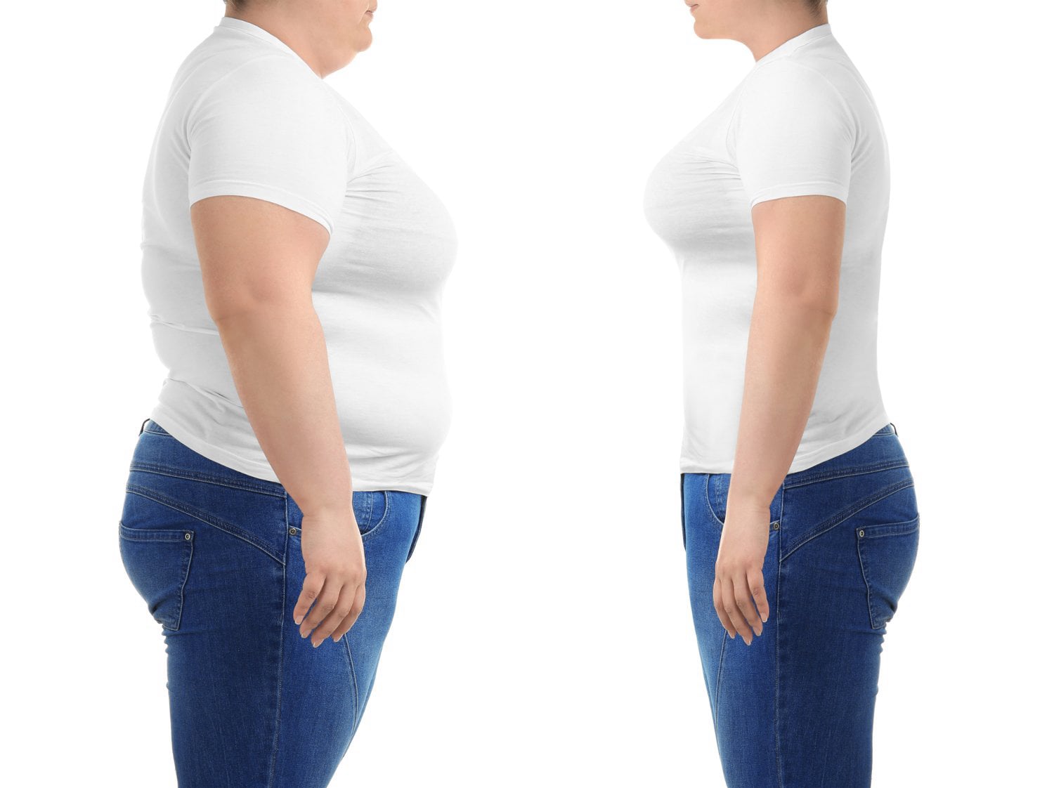 Medical Weight Loss Wellington, FL