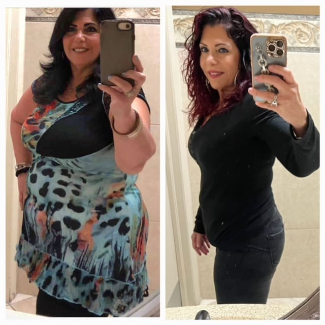 Weight Loss Program in Wellington, FL by Beyond Concierge Healthcare