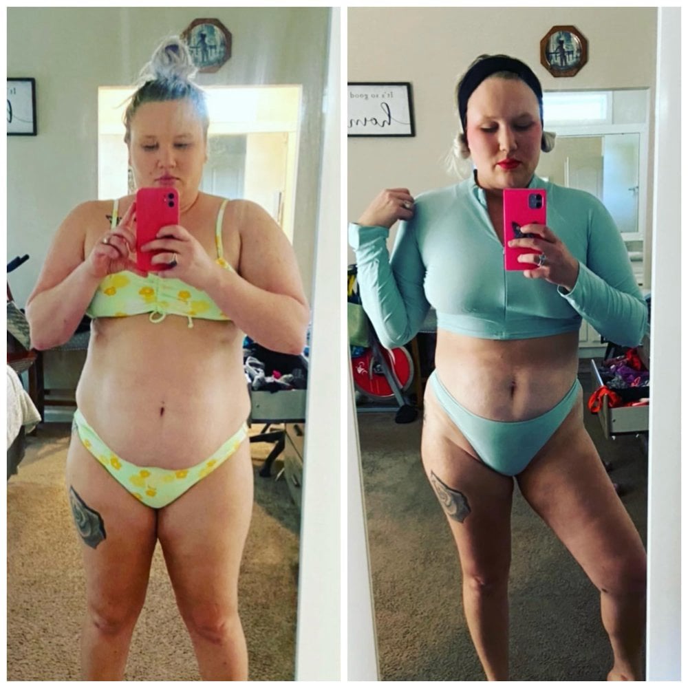 Weight Loss Before and After Wellington, FL